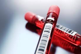 blood tests