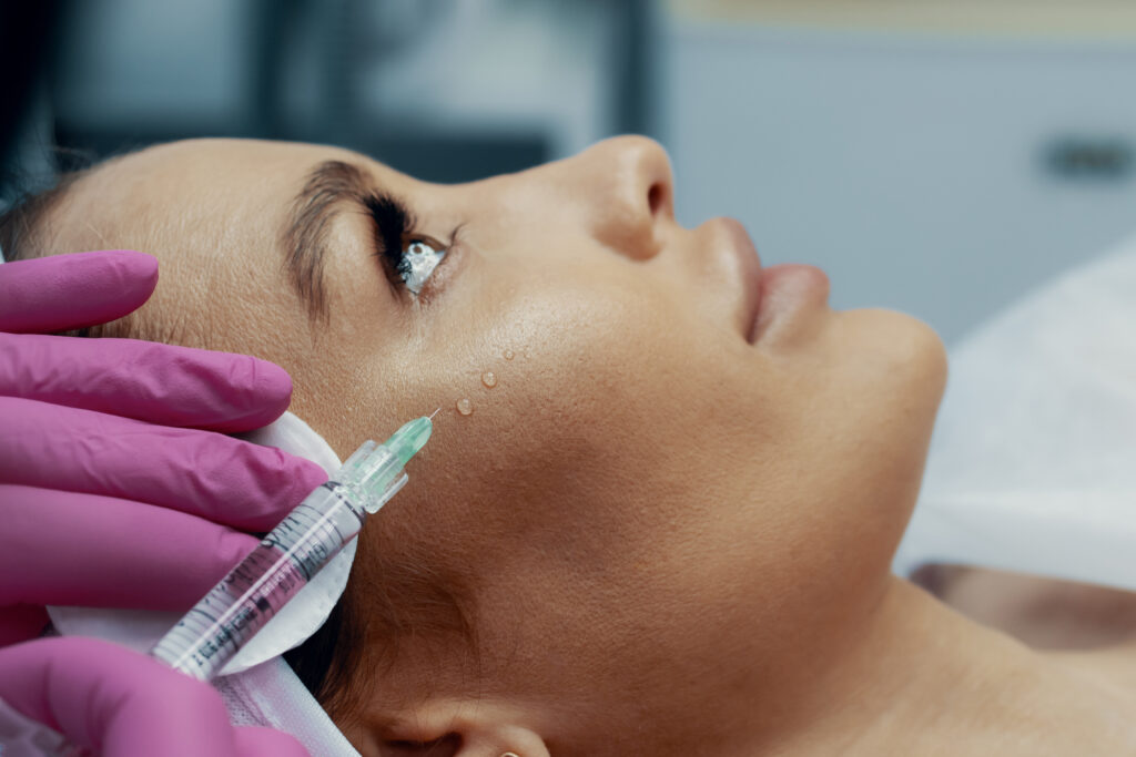 Subcision For Acne Scars Treatment In Leeds The Leeds Clinic