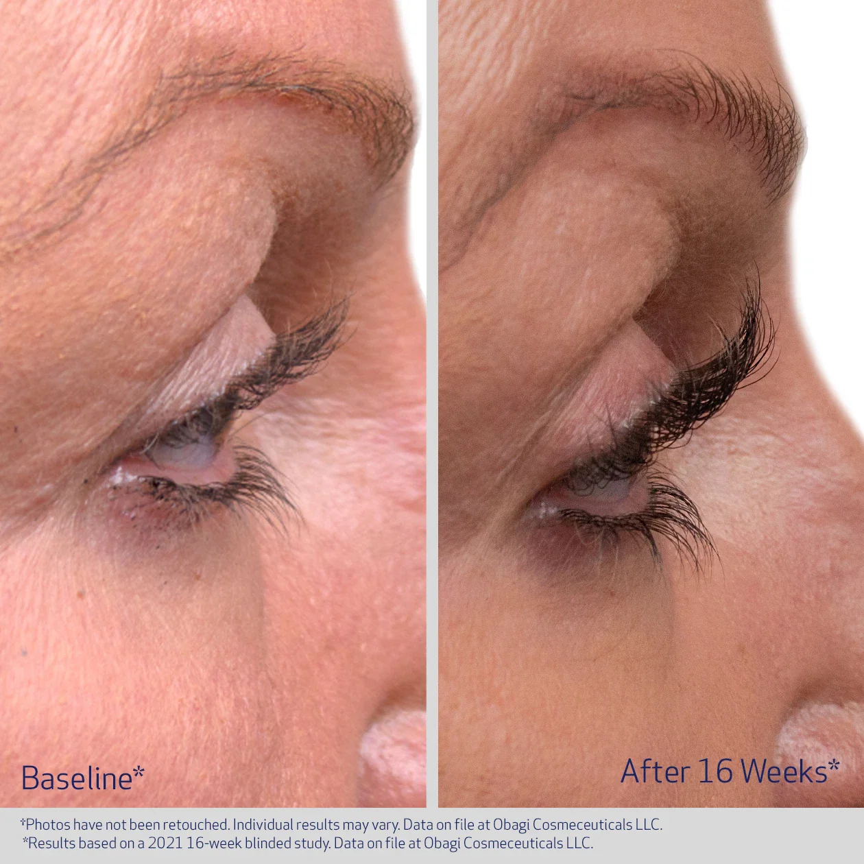 Obagi Nu-Cil™ Eyelash Enhancing Serum 3ml - Image 3