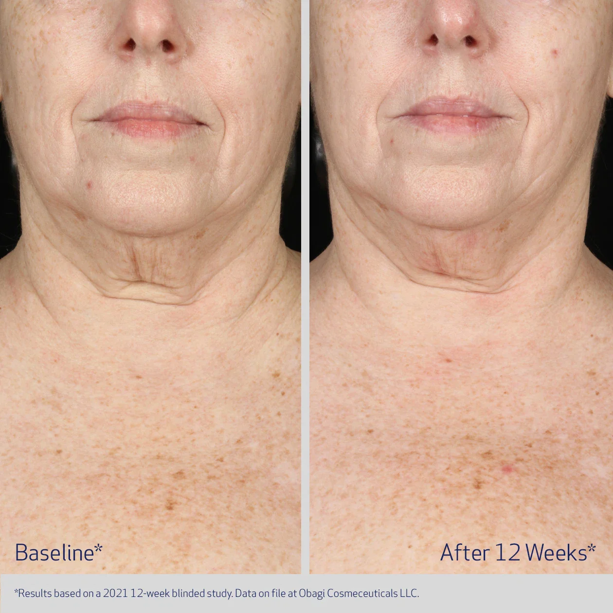 NECK AND DÉCOLLETÉ CONCENTRATE - Image 3