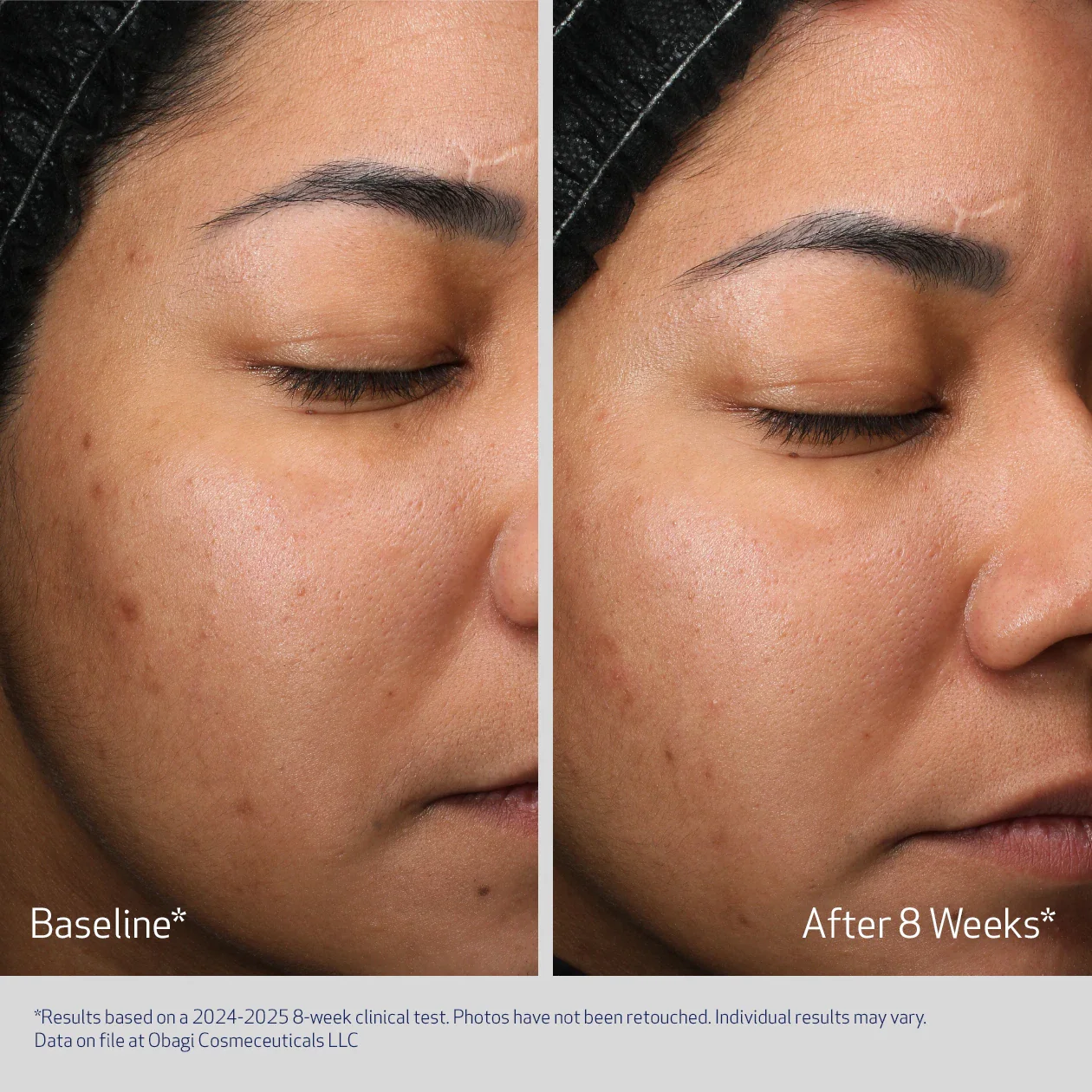 RETINOL + PHA - Image 3