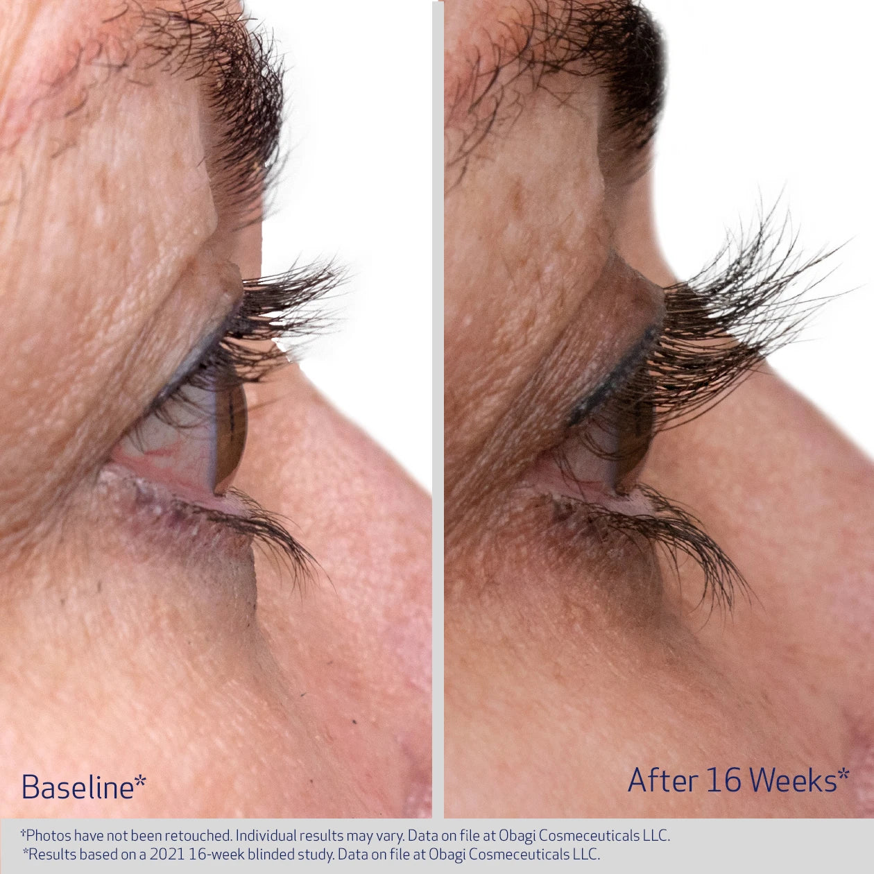 Obagi Nu-Cil™ Eyelash Enhancing Serum 3ml - Image 2