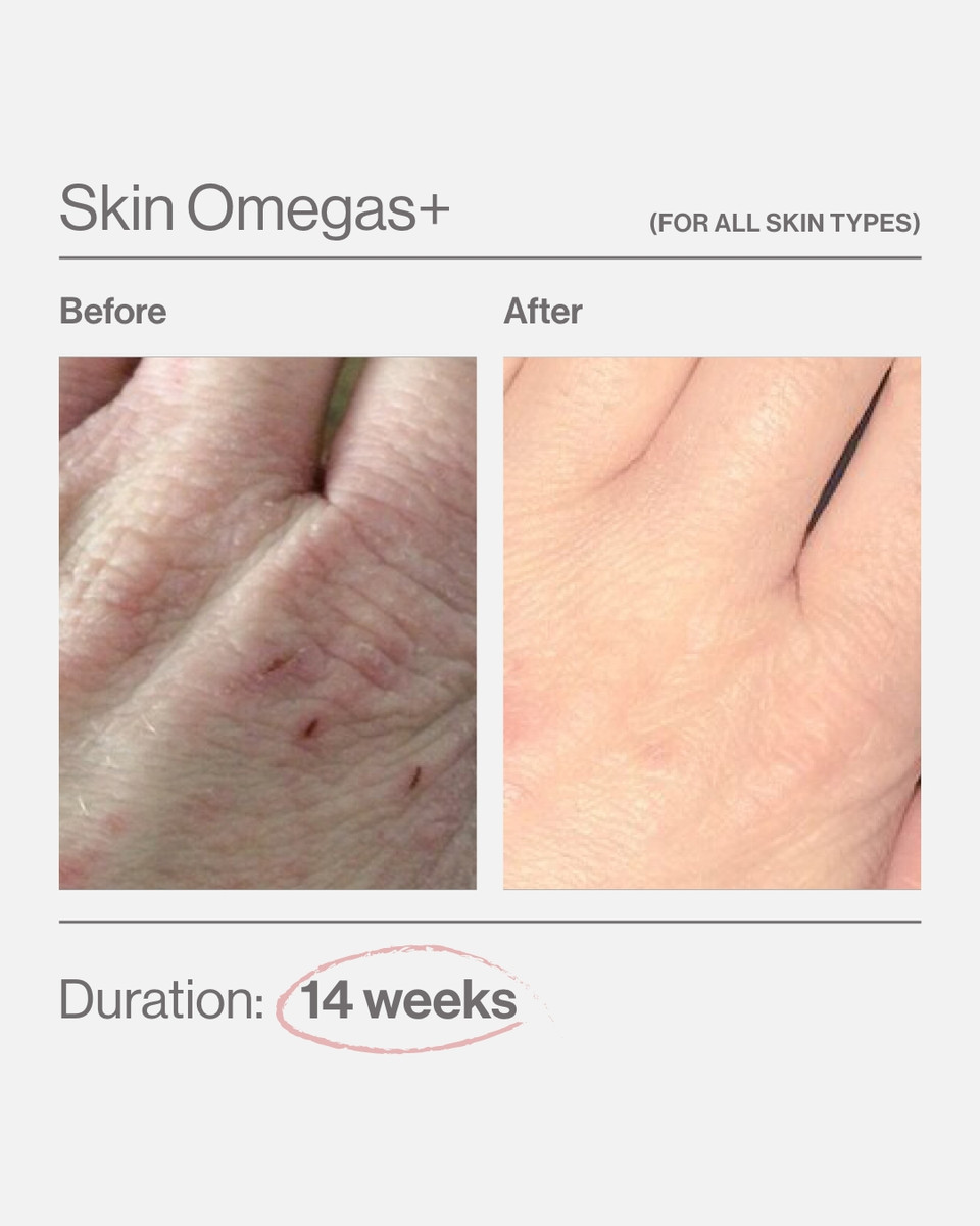 Advanced Nutrition Programme Skin Omegas+ 180 Softgels - Image 3
