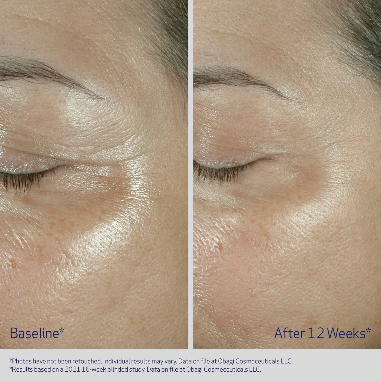 EYE CREAM - Image 4