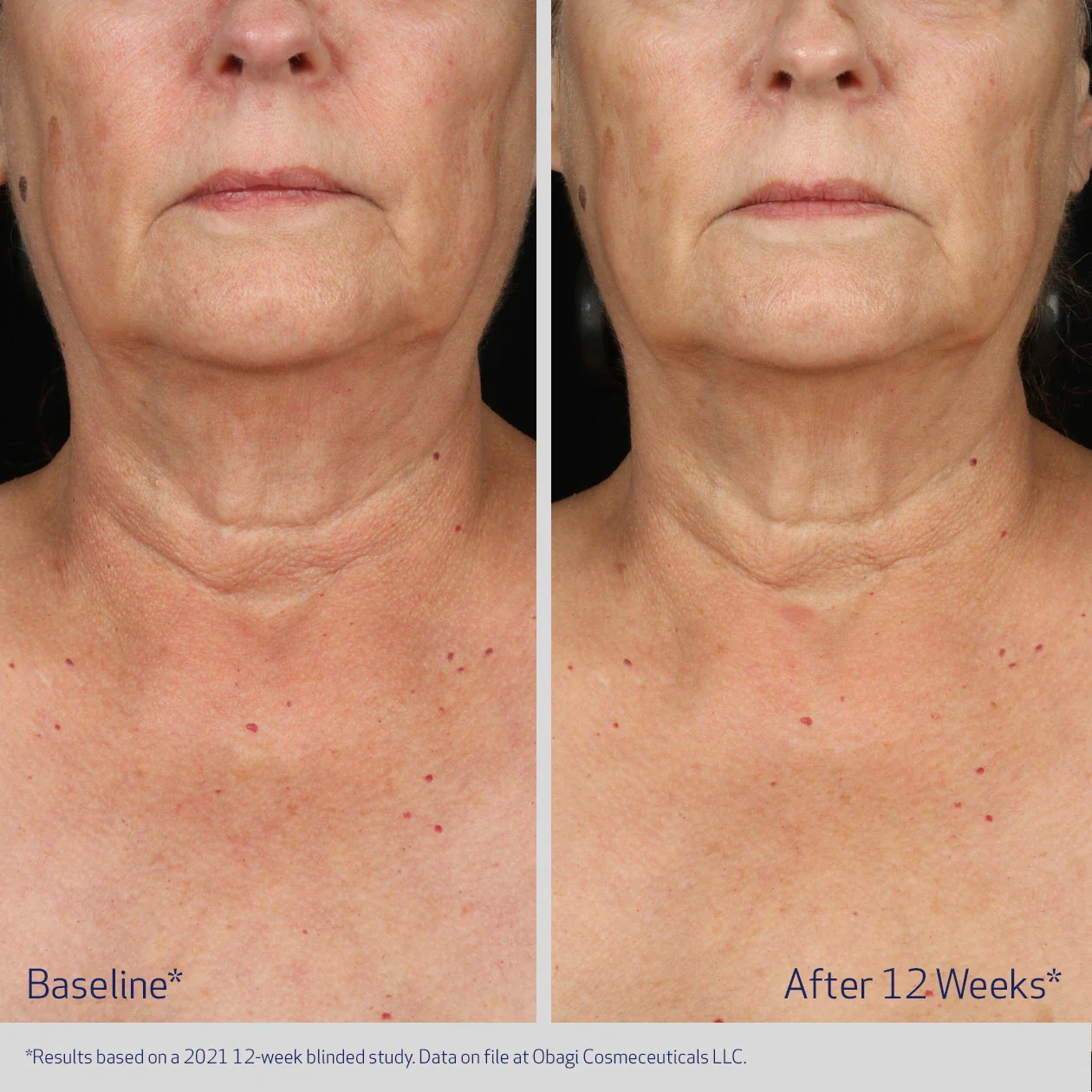 NECK AND DÉCOLLETÉ CONCENTRATE - Image 2