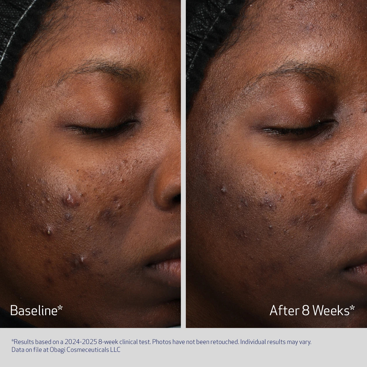 RETINOL + PHA - Image 2