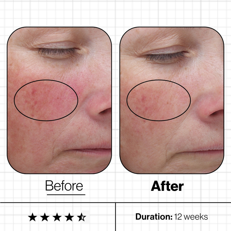 Skin Even IQ - Image 4