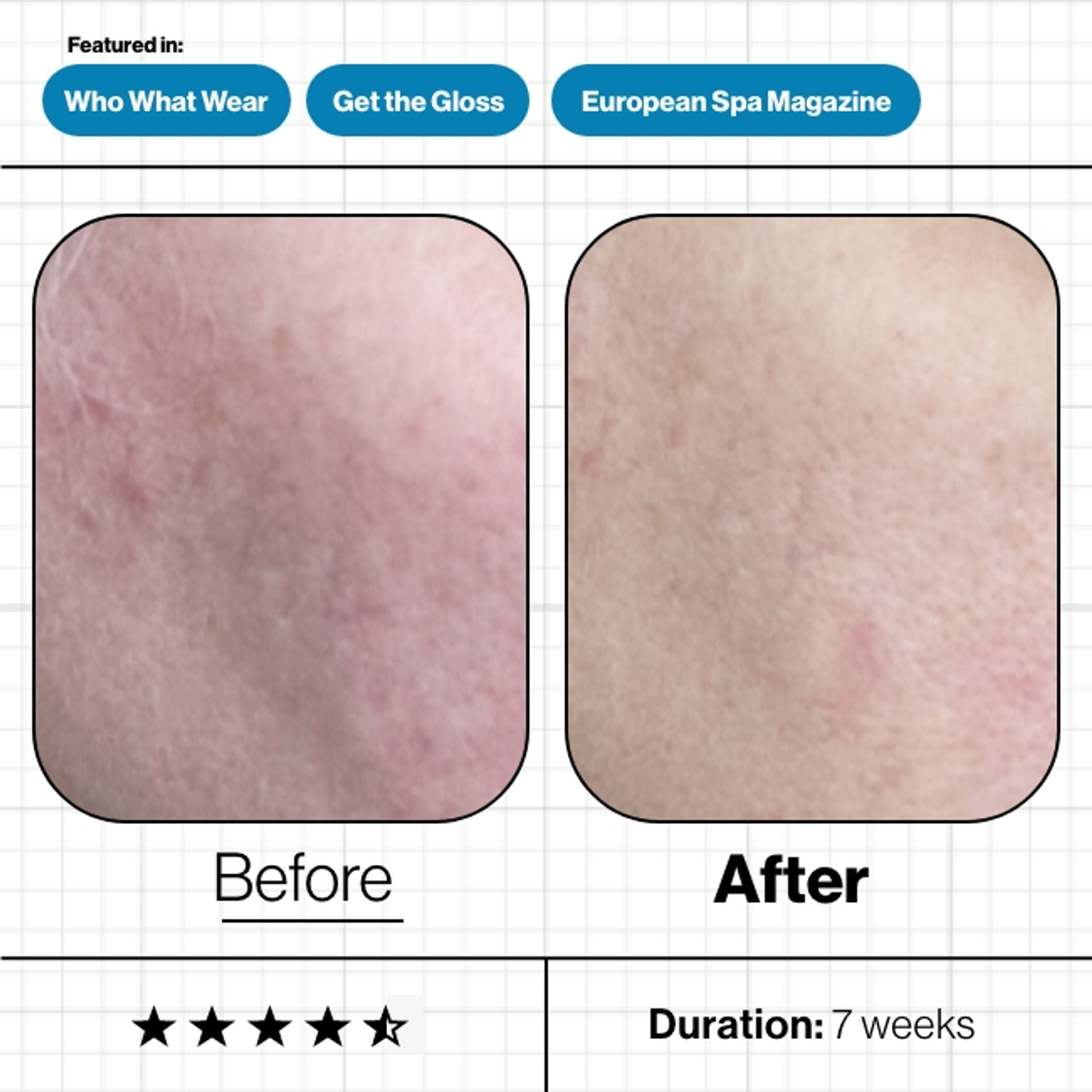 Skin Moisture IQ - Image 2