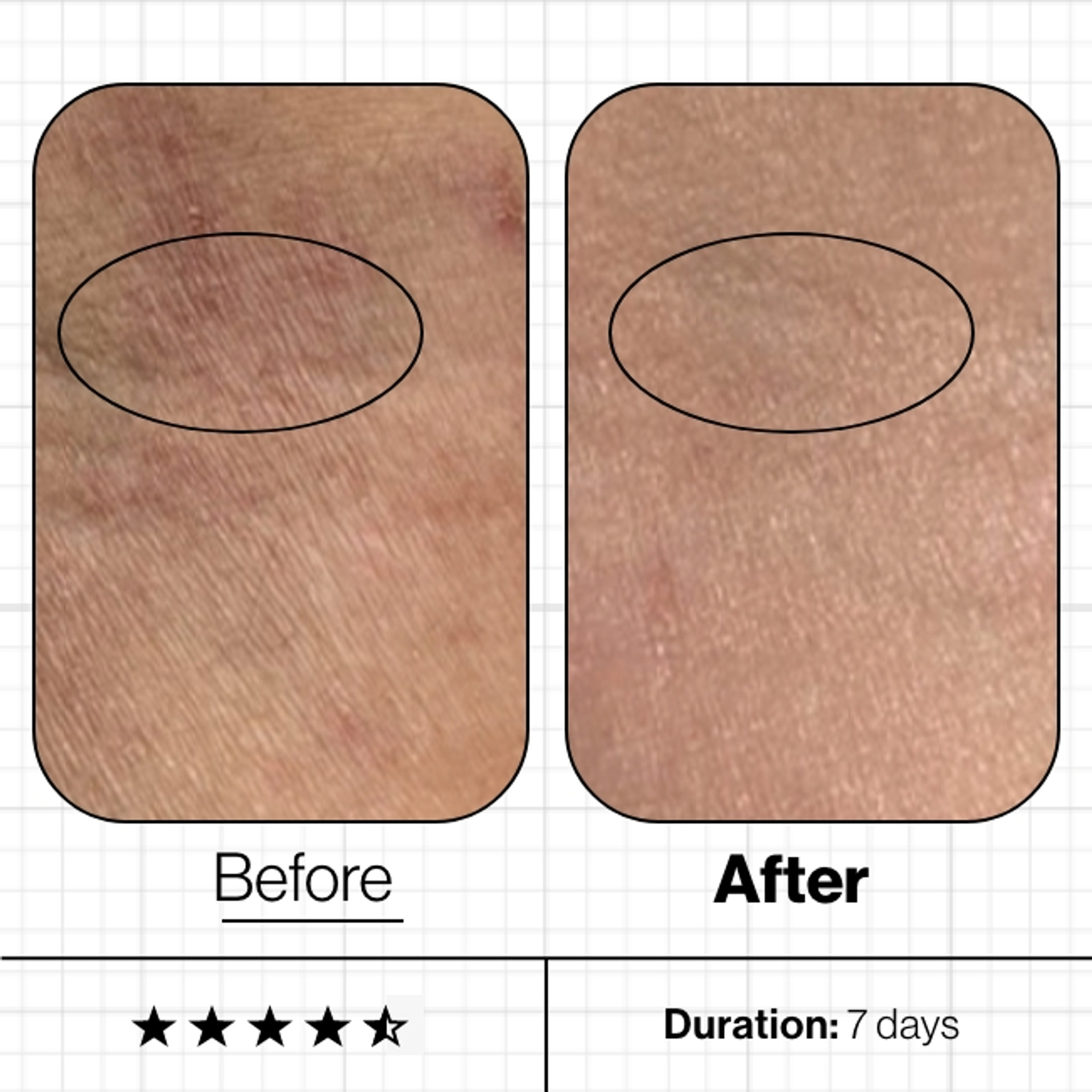 Skin Moisture IQ - Image 3